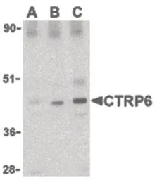 Anti-CTRP6 antibody used in Western Blot (WB). GTX85668