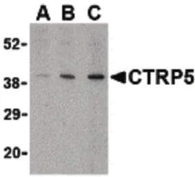 Anti-CTRP5 antibody used in Western Blot (WB). GTX85671