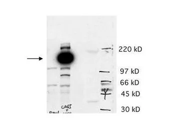 Anti-CASZ1 antibody used in Western Blot (WB). GTX85729