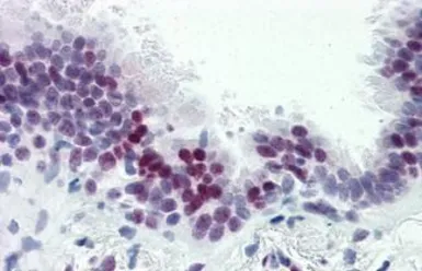 Anti-CASZ1 antibody used in IHC (Paraffin sections) (IHC-P). GTX85729