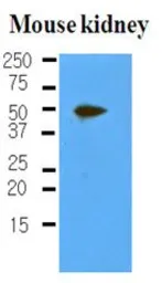Anti-Podoplanin antibody [5E2] used in Western Blot (WB). GTX85772