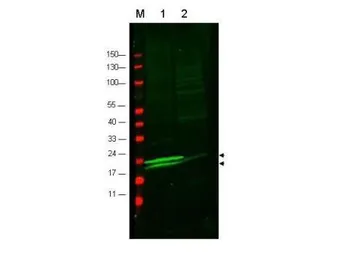 Anti-Myosin Light Chain 2 antibody used in Western Blot (WB). GTX85778