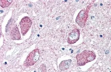 Anti-Wnt8b antibody used in IHC (Paraffin sections) (IHC-P). GTX85814