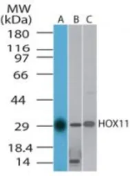 Anti-TLX1 antibody used in Western Blot (WB). GTX85867