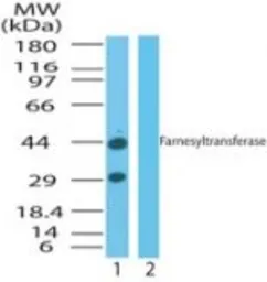 Anti-FNTA antibody used in Western Blot (WB). GTX85881