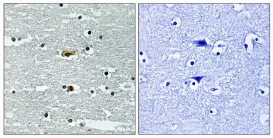 Anti-STK39 (phospho Ser311) antibody used in IHC (Paraffin sections) (IHC-P). GTX86495