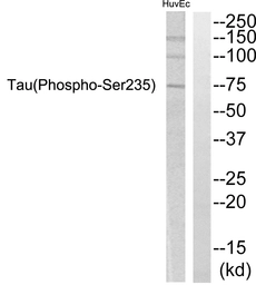 Anti-Tau (phospho Ser235) antibody used in Western Blot (WB). GTX86624