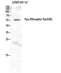 Anti-FYN (phospho Tyr530) antibody used in Western Blot (WB). GTX86757
