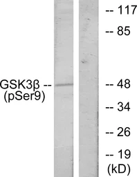 Anti-GSK3 beta (phospho Ser9) antibody used in Western Blot (WB). GTX86837