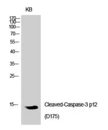 Anti-Caspase 3 (cleaved Asp175) antibody used in Western Blot (WB). GTX86900