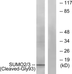 Anti-SUMO2 + SUMO3 (cleaved Gly93) antibody used in Western Blot (WB). GTX86908