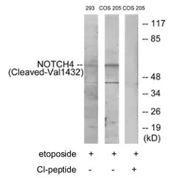 Anti-NOTCH4 (cleaved Val1432) antibody used in Western Blot (WB). GTX86910