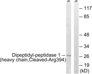 Anti-Cathepsin C (cleaved Arg394) antibody used in Western Blot (WB). GTX86919