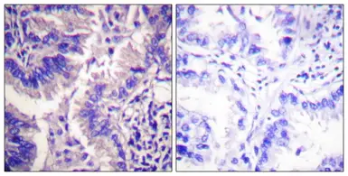 Anti-Caspase 9 (cleaved Asp315) antibody used in IHC (Paraffin sections) (IHC-P). GTX86945