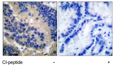 Anti-Caspase 3 (cleaved Asp175) antibody used in IHC (Paraffin sections) (IHC-P). GTX86952