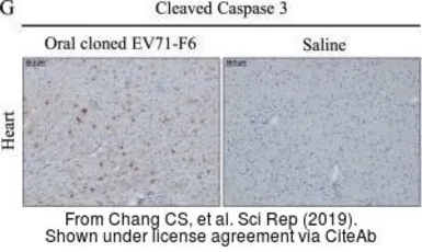 Anti-Caspase 3 (cleaved Asp175) antibody used in Immunohistochemistry (IHC). GTX86952