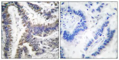 Anti-ICAD (cleaved Asp224) antibody used in IHC (Paraffin sections) (IHC-P). GTX86959
