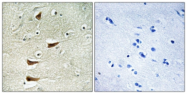 Anti-MLK2 antibody used in IHC (Paraffin sections) (IHC-P). GTX86985