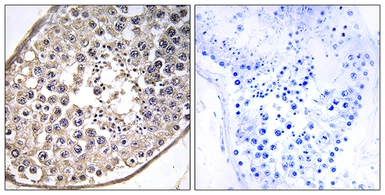 Anti-DNAL4 antibody used in IHC (Paraffin sections) (IHC-P). GTX86991