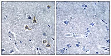 Anti-ARRDC2 antibody used in IHC (Paraffin sections) (IHC-P). GTX87002