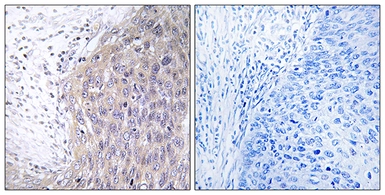 Anti-POLG2 antibody used in IHC (Paraffin sections) (IHC-P). GTX87063