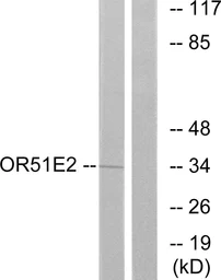 Anti-OR51E2 antibody used in Western Blot (WB). GTX87083