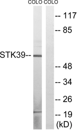Anti-STK39 antibody used in Western Blot (WB). GTX87091