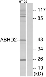 Anti-ABHD2 antibody used in Western Blot (WB). GTX87133