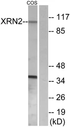 Anti-XRN2 antibody used in Western Blot (WB). GTX87148