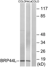 Anti-BRP44L antibody used in Western Blot (WB). GTX87153