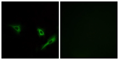 Anti-ATG4A antibody used in Immunocytochemistry/ Immunofluorescence (ICC/IF). GTX87155