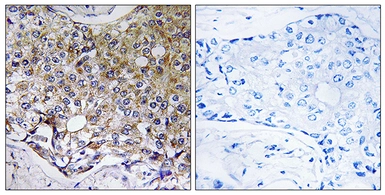 Anti-ATG4A antibody used in IHC (Paraffin sections) (IHC-P). GTX87155