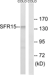 Anti-SFRS15 antibody used in Western Blot (WB). GTX87159