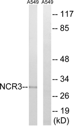 Anti-NCR3 antibody used in Western Blot (WB). GTX87179