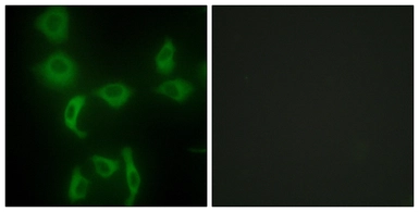 Anti-IARS2 antibody used in Immunocytochemistry/ Immunofluorescence (ICC/IF). GTX87187