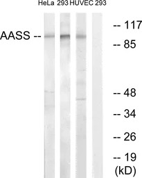 Anti-AASS antibody used in Western Blot (WB). GTX87191