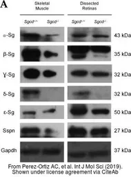 Anti-alpha Sarcoglycan antibody used in Western Blot (WB). GTX87192