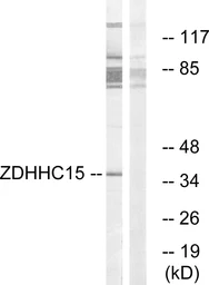 Anti-ZDHHC15 antibody used in Western Blot (WB). GTX87194