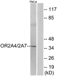Anti-OR2A4 + OR2A7 antibody used in Western Blot (WB). GTX87198