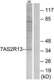 Anti-TAS2R13 antibody used in Western Blot (WB). GTX87215