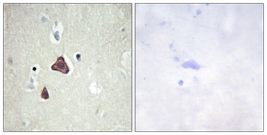 Anti-ADCY8 antibody used in IHC (Paraffin sections) (IHC-P). GTX87216