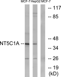 Anti-NT5C1A antibody used in Western Blot (WB). GTX87233