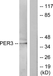 Anti-PER3 antibody used in Western Blot (WB). GTX87243