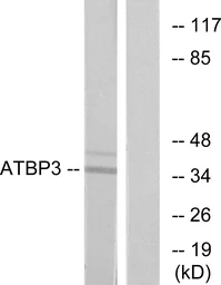 Anti-ATPBD3 antibody used in Western Blot (WB). GTX87262