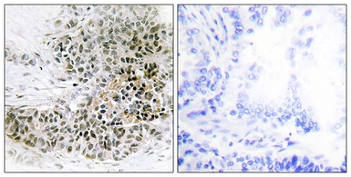 Anti-TRPS1 antibody used in IHC (Paraffin sections) (IHC-P). GTX87272