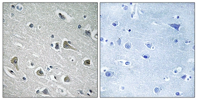 Anti-MYLIP antibody used in IHC (Paraffin sections) (IHC-P). GTX87284