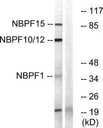 Anti-NBPF1/9/10/12/14/15/16/20 antibody used in Western Blot (WB). GTX87305