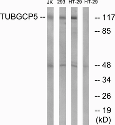 Anti-TUBGCP5 antibody used in Western Blot (WB). GTX87308