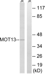 Anti-MCT13 antibody used in Western Blot (WB). GTX87317
