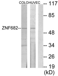 Anti-ZNF682 antibody used in Western Blot (WB). GTX87329